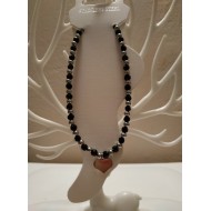 Βραχιόλια για πόδια